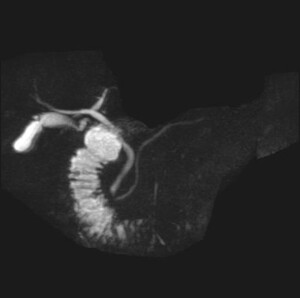 MRCP1.jpg